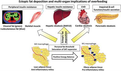 The Impact of Macronutrient Intake on Non-alcoholic Fatty Liver Disease (NAFLD): Too Much Fat, Too Much Carbohydrate, or Just Too Many Calories?